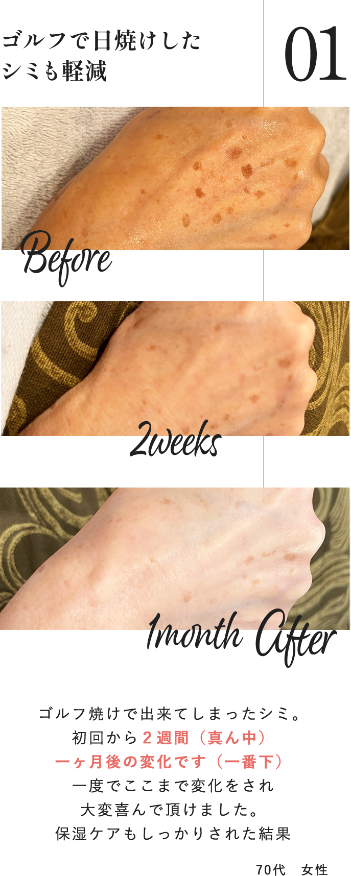 70代女性ユーザーの声