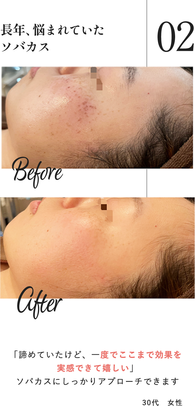 30代女性ユーザーの声