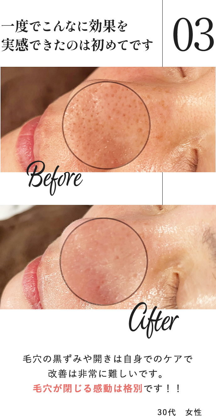 30代女性ユーザーの声